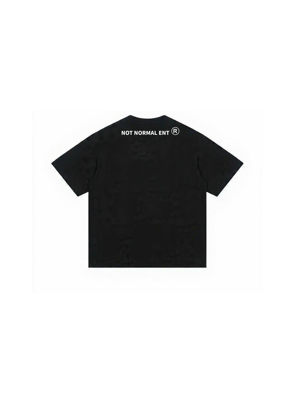 ANOMAL