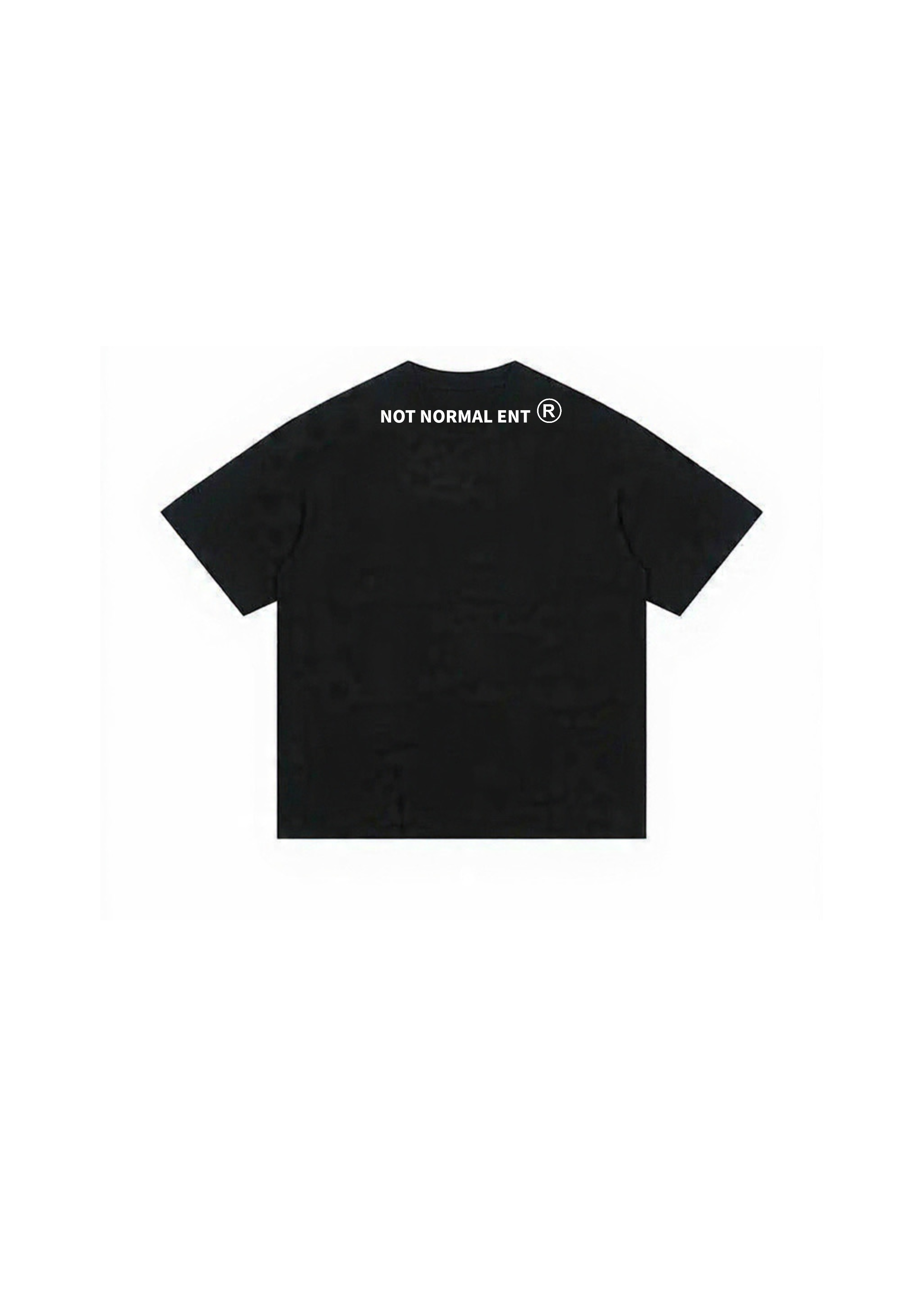 ANOMAL